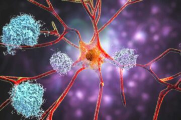 Povestea tulburătoare a celei mai tinere persoane diagnosticate cu boala Alzheimer