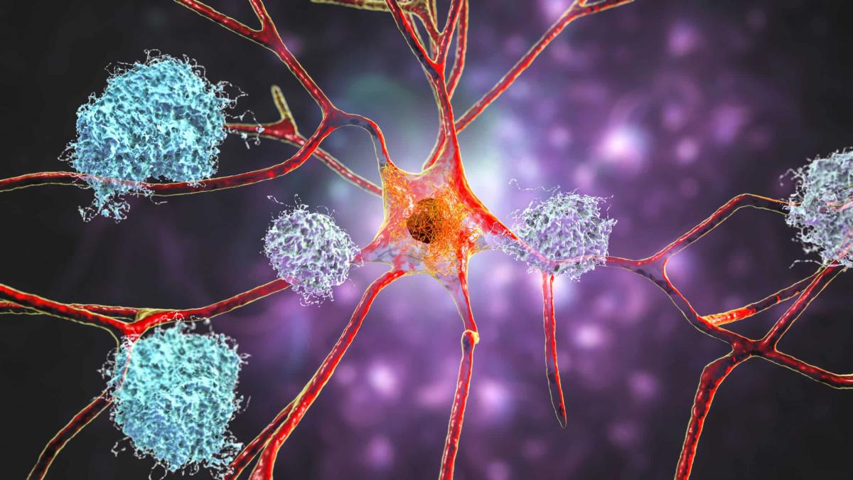 Povestea tulburătoare a celei mai tinere persoane diagnosticate cu boala Alzheimer
