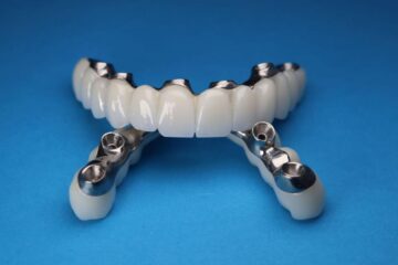 Cum alegi între implanturile dentare All on 4 și All on 6